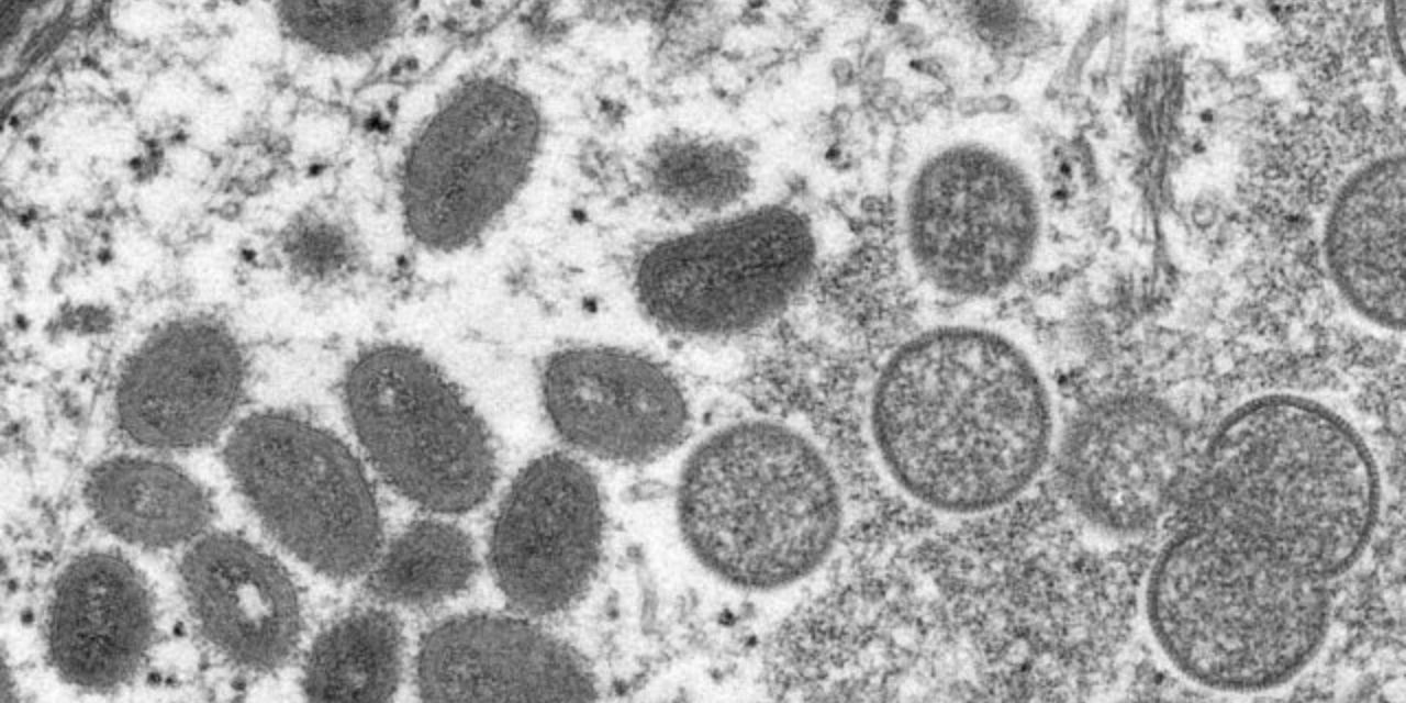 OMS confirma otros dos casos de virus de Marburgo en Ghana | El Imparcial de Oaxaca