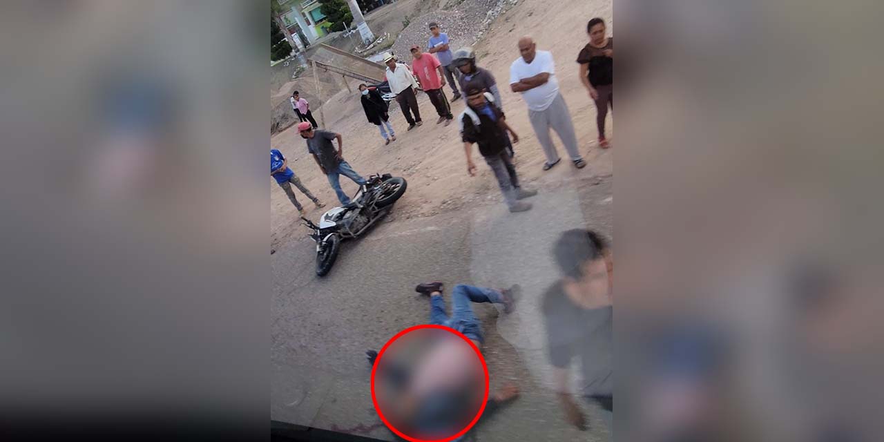 Motociclista sale herido gravemente en colisión vial