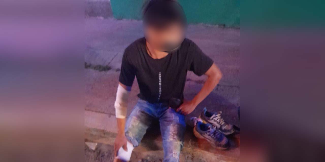 Se le atraviesa un perro y derrapa