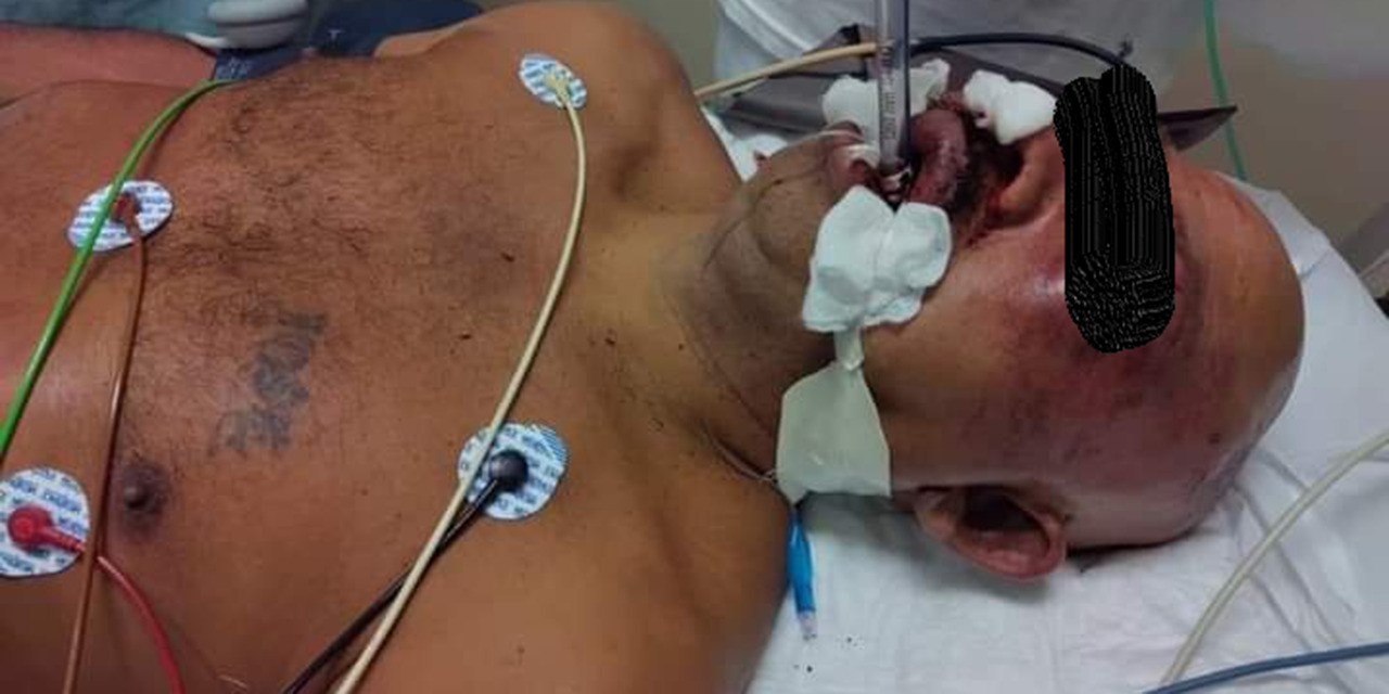 Recibe tremenda golpiza al tratar de agredir a una persona en Colotepec | El Imparcial de Oaxaca