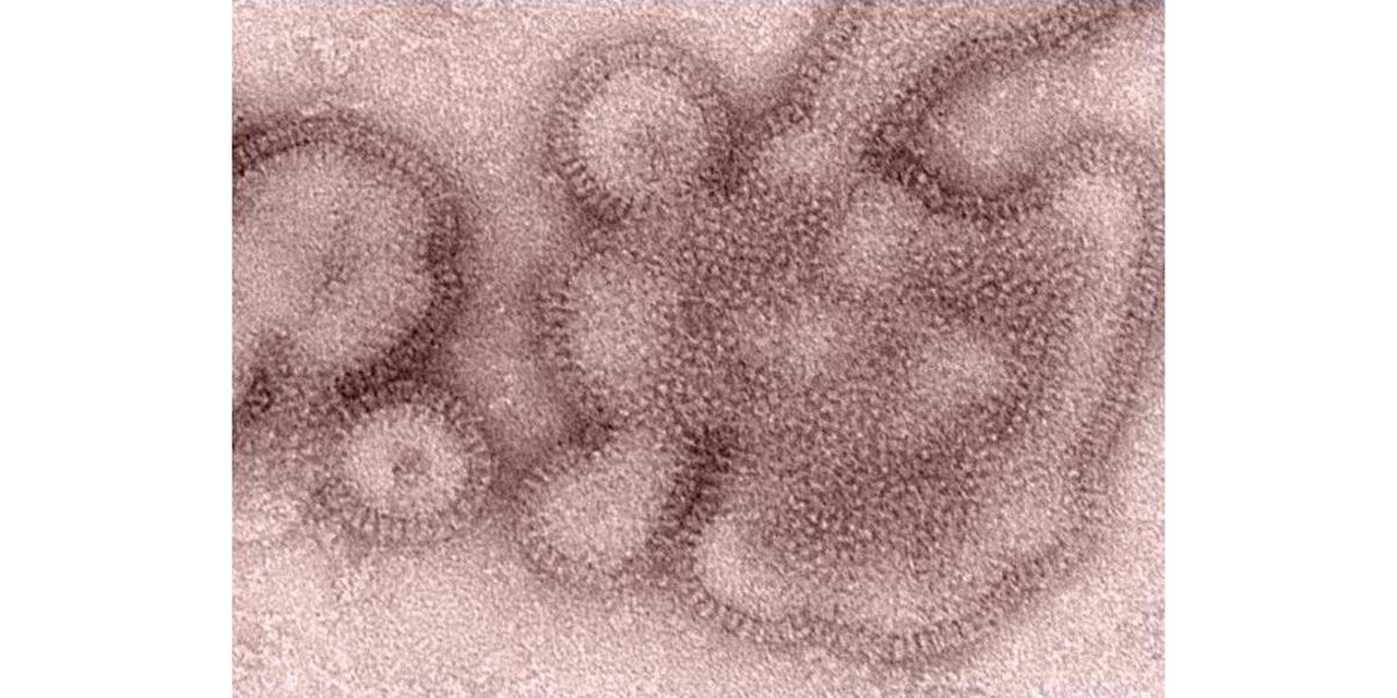Lo que se sabe de la ‘mortal’ cepa H3N2 de la influenza | El Imparcial de Oaxaca