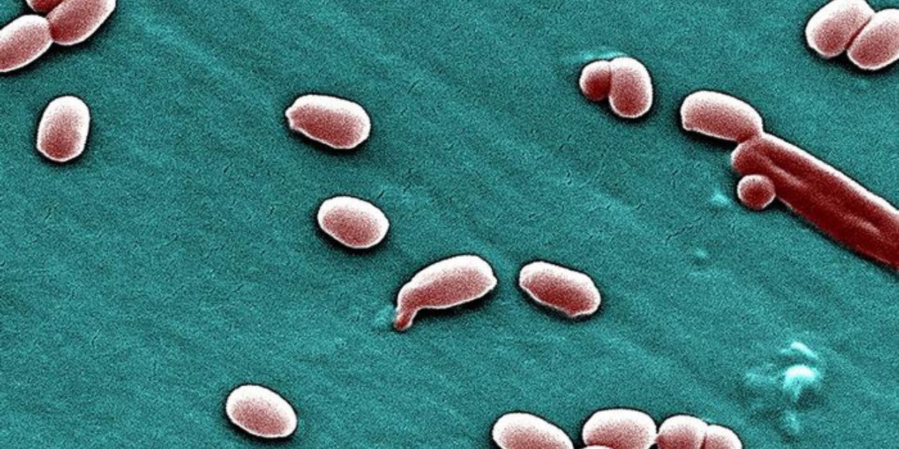 Investigadores detectan actividad inesperada en bacterias “muertas” | El Imparcial de Oaxaca