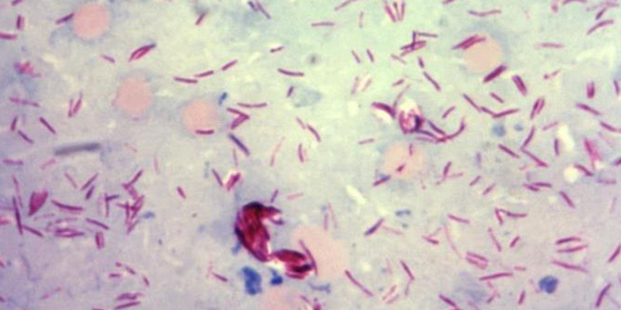 La bacteria parasitaria que causa la lepra podría tener sorprendentes facultades curativas | El Imparcial de Oaxaca