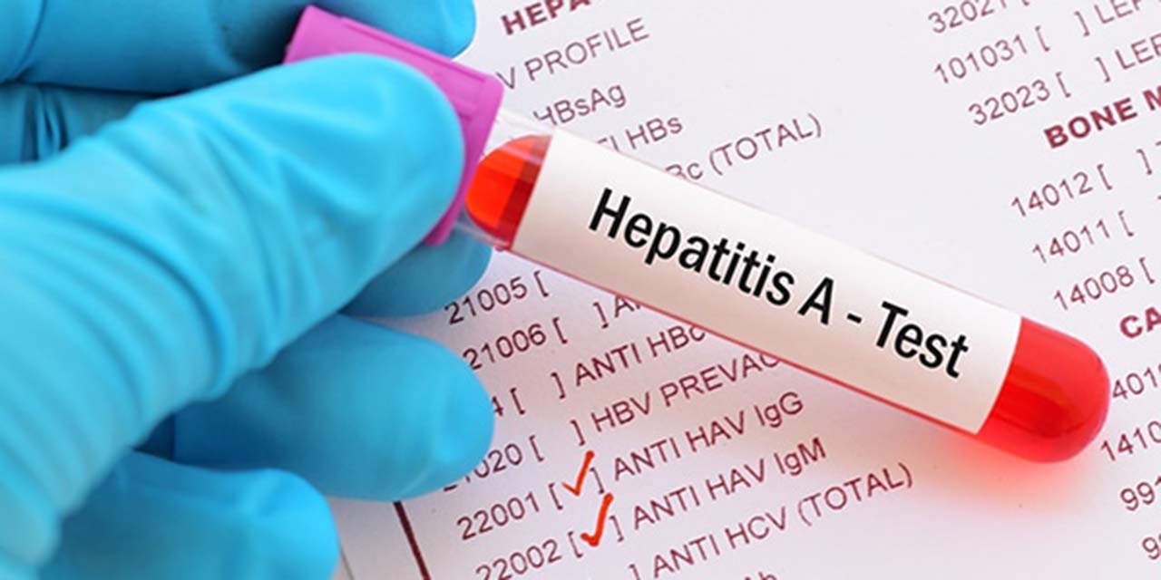Se duplican casos de hepatitis A en Oaxaca | El Imparcial de Oaxaca