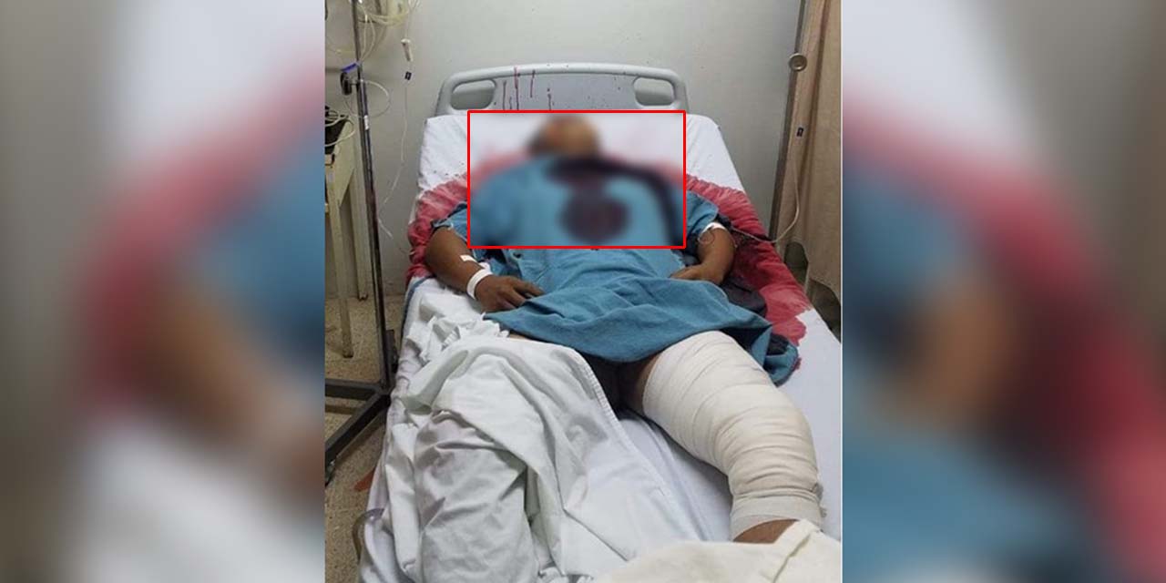 Entran a rematarlo en el hospital de Pochutla