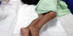 Foto: archivo / El Hospital de la Niñez dará de alta a menor con diagnóstico de tétanos