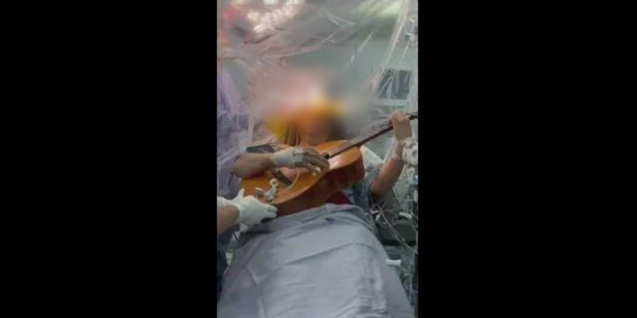 Video: Toca la guitarra en plena cirugía mientras le quitan un tumor | El Imparcial de Oaxaca