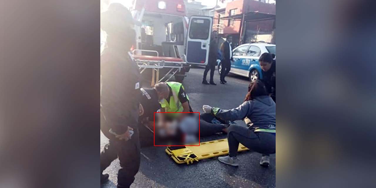 Ciudadana sale herida en accidente | El Imparcial de Oaxaca