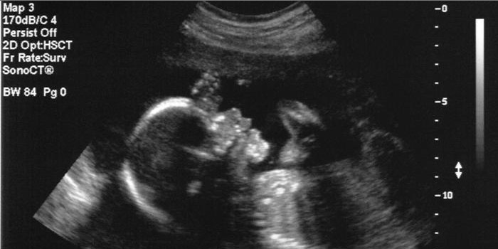 Realizan con éxito la primera cirugía cerebral a un feto