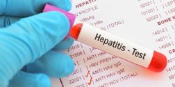 Foto: internet / Análisis clínicos para detectar hepatitis