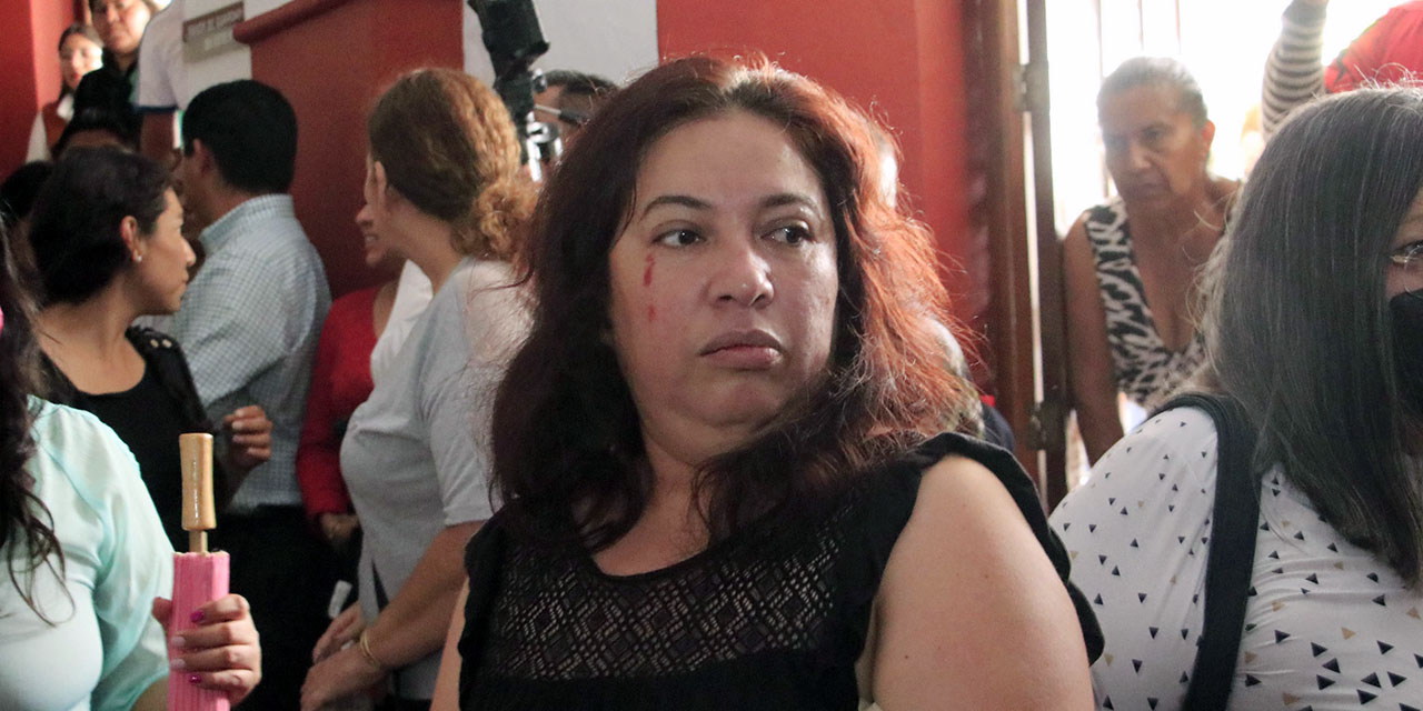 Foto: Adrián Gaytán / Una mujer con un hematoma causado por la agresión de ambulantes en la propia Casa de Pueblo.