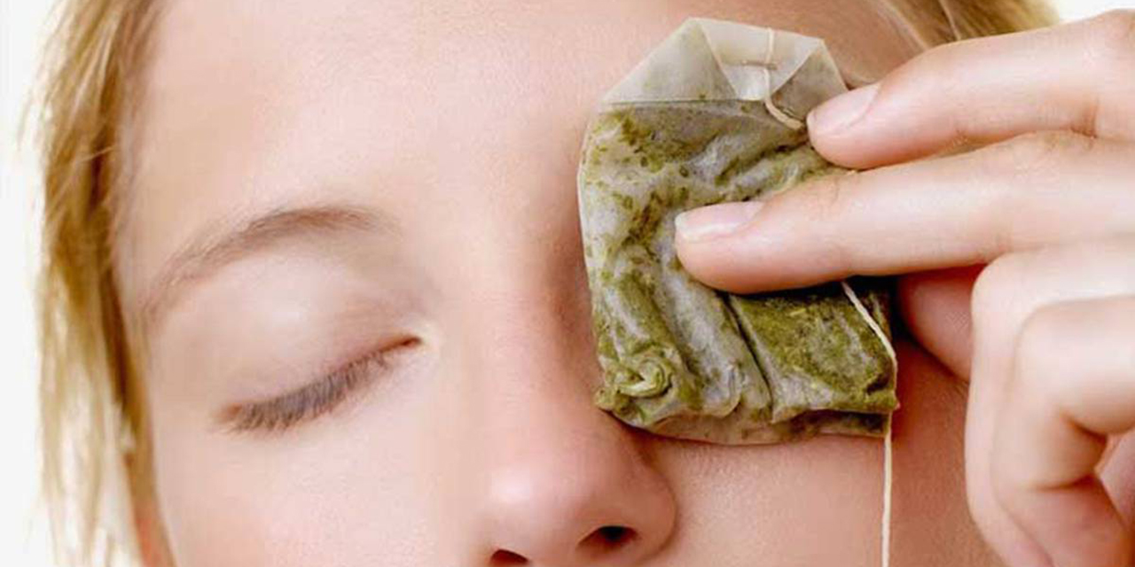 ¿Tienes ojeras? eliminalas con estos remedios