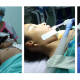 Concluye con éxito Jornada Quirúrgica de Cirugía Reconstructiva Pediátrica en Hospital IMSS de Tlaxiaco