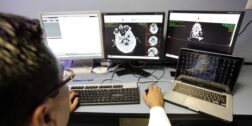 Foto: internet / Doctor analizando estudios para identificar o descartar males cerebrovasculares.