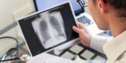 Foto: internet-ilustrativa // La tuberculosis es una enfermedad bacteriana infecciosa, potencialmente grave, que afecta principalmente a los pulmones.