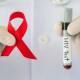Repuntan los casos de VIH en etapas avanzadas