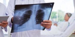 Foto: internet - ilustrativa // En uno de sus tipos, la tuberculosis suele afectar a los pulmones.