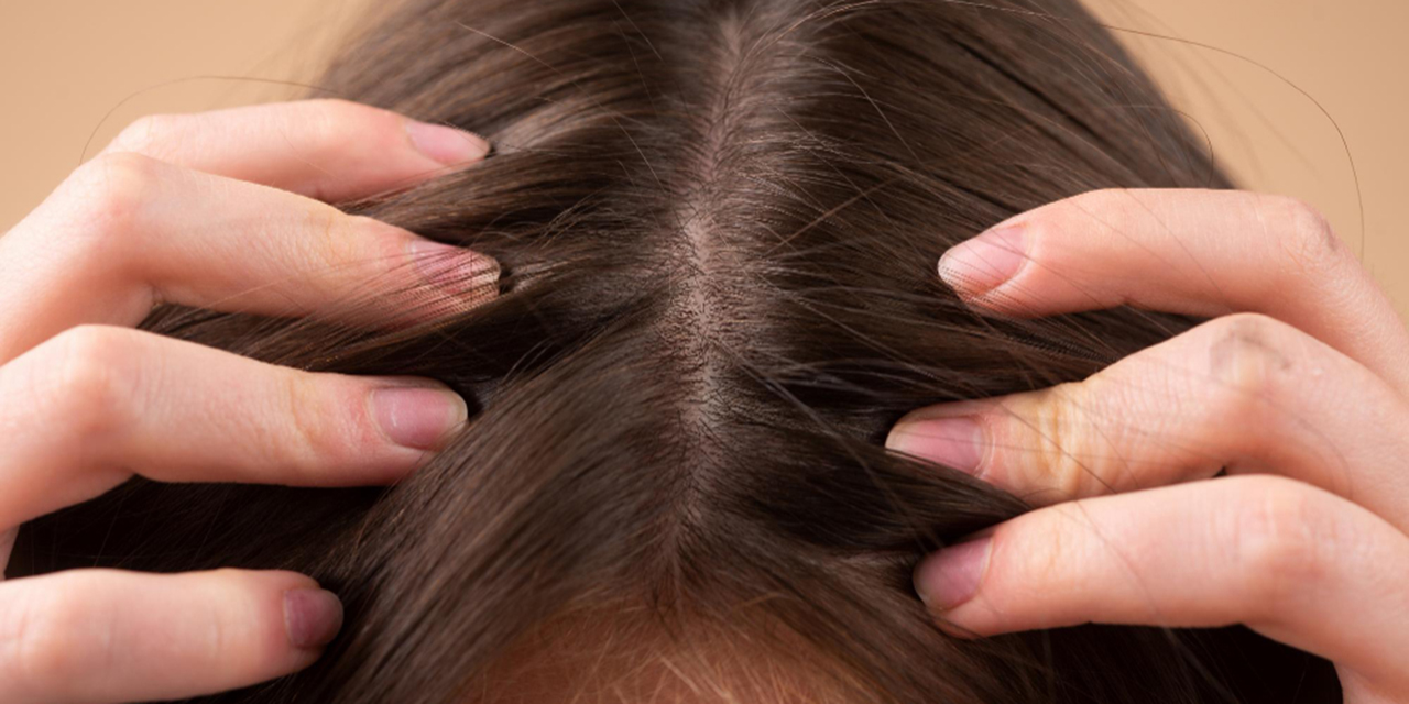 ¿Cuál es la mejor vitamina para ayudar a que el cabello no se caiga? | El Imparcial de Oaxaca