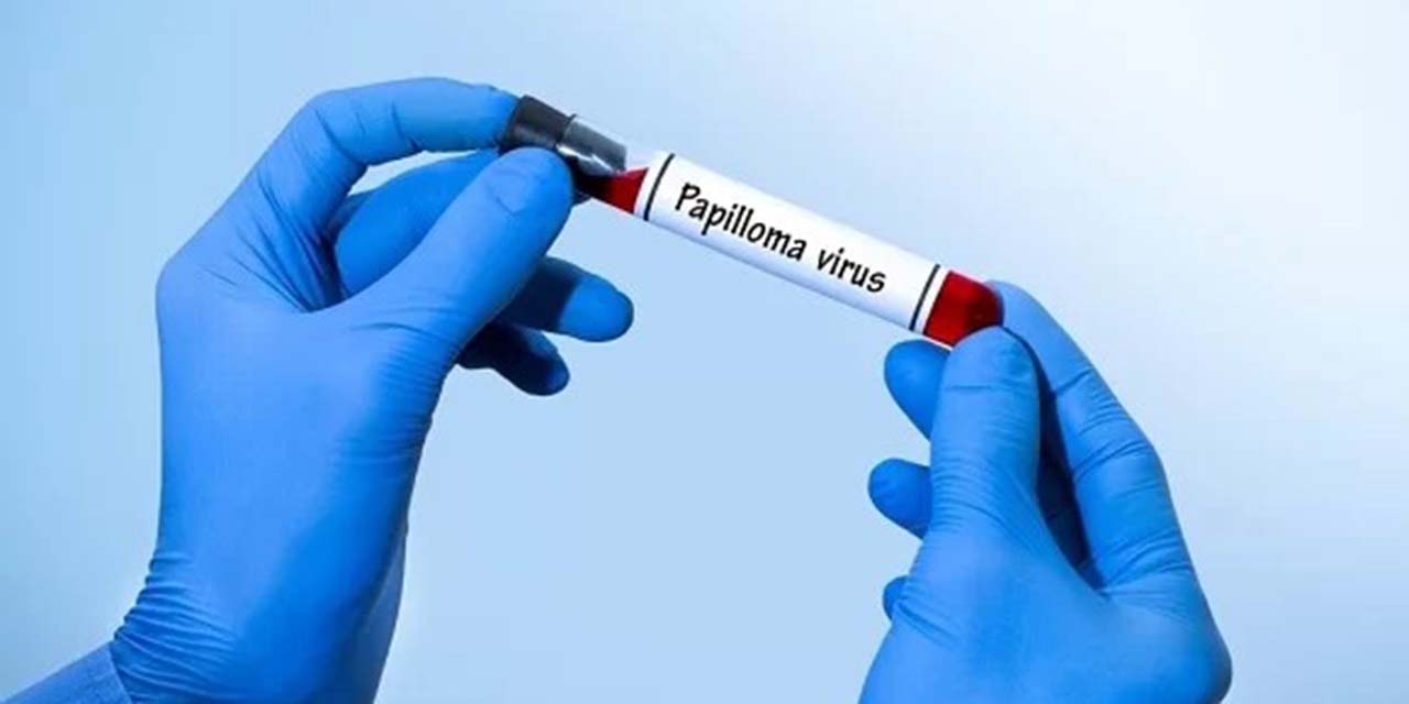 Foto: internet – ilustrativa // Los SSO invitó a las madres y padres de familia a informarse en fuentes oficiales para evitar la desinformación y romper tabús acerca de la vacuna contra el VPH.