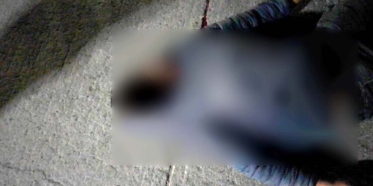 El joven de 23 años de edad resultó con heridas de consideración al no portar casco de seguridad.