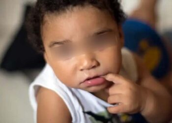 Foto: Agencias // Bebé nacido con microcefalia por el zika.