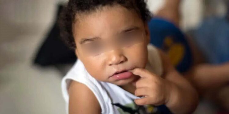 Foto: Agencias // Bebé nacido con microcefalia por el zika.