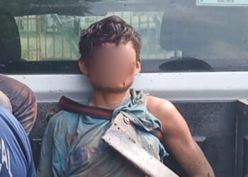 ¡Delirante! Enloquece y casi le arranca la cabeza a policía a machetazos en la Costa
