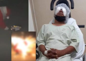 VIDEO | Precaución con la pirotecnia: Joven pierde un ojo en Coahuila por explosión de cohete