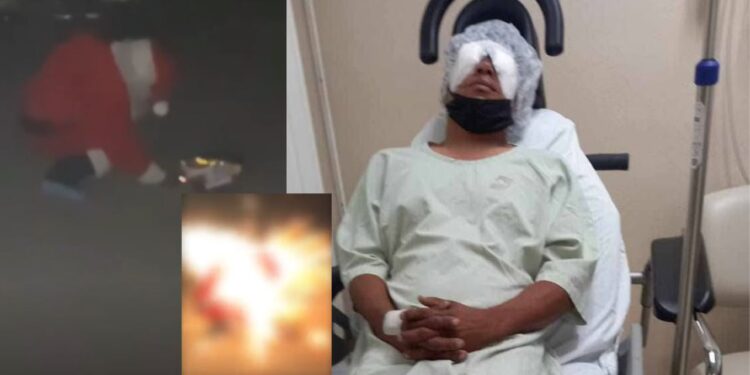 VIDEO | Precaución con la pirotecnia: Joven pierde un ojo en Coahuila por explosión de cohete