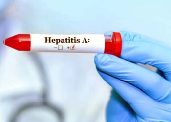Foto: internet – ilustrativa // En Oaxaca el sector salud notificó 193 casos de hepatitis A hasta la semana epidemiológica 50 de 2024.