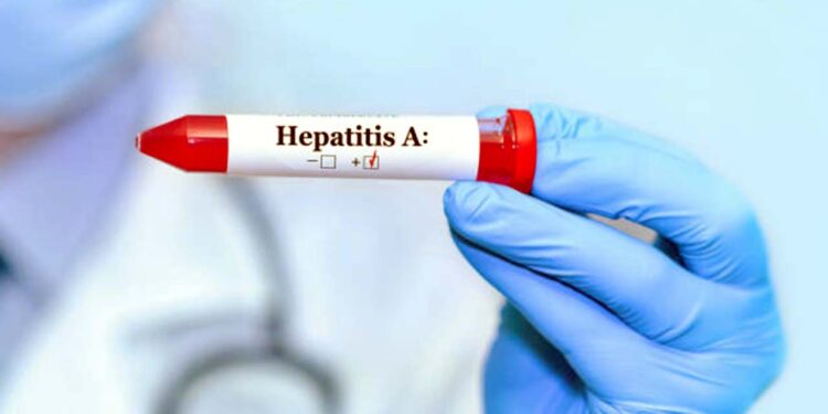 Foto: internet – ilustrativa // En Oaxaca el sector salud notificó 193 casos de hepatitis A hasta la semana epidemiológica 50 de 2024.