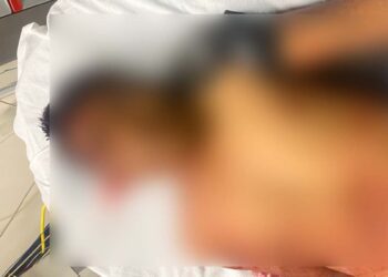 Se encuentra recibiendo atención médica en el hospital básico de Río Grande.
