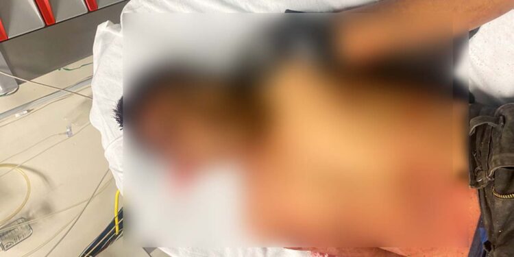 Se encuentra recibiendo atención médica en el hospital básico de Río Grande.