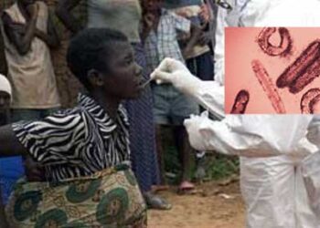 ¿Es el virus Marburgo una nueva amenaza global? OMS emite alerta por brote mortal en Tanzania