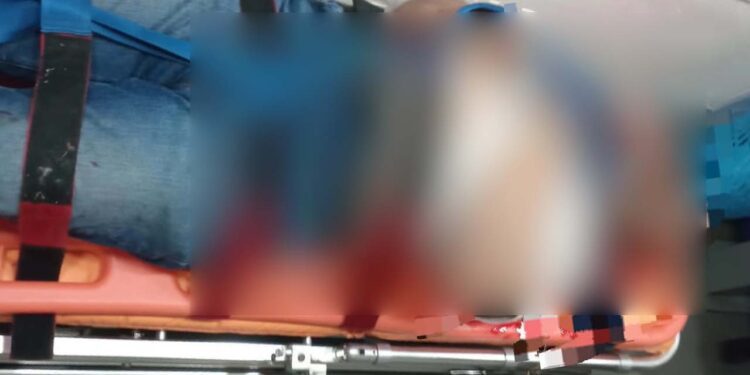 El joven salió disparado con todo y su moto hacia el río de Ocotlán.