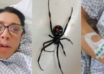 Cynthia Klitbo revela haber sido mordida por una peligrosa araña “viuda negra”