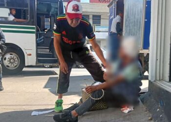 La mujer sufrió un fuerte golpe en la cabeza.