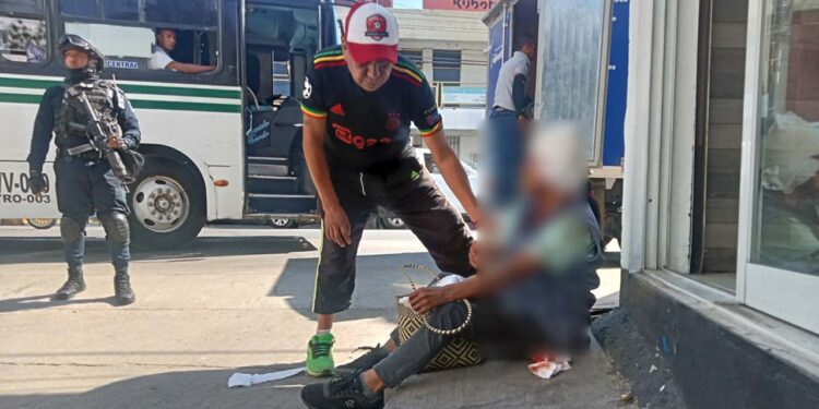 La mujer sufrió un fuerte golpe en la cabeza.
