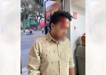 La víctima fue agredida por el guardia de seguridad sin razón aparente.