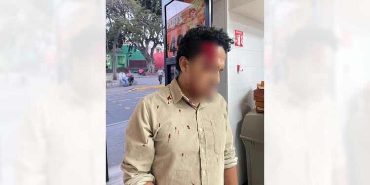 La víctima fue agredida por el guardia de seguridad sin razón aparente.