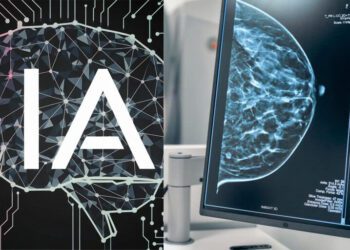 IA en el diagnóstico del cáncer de mama