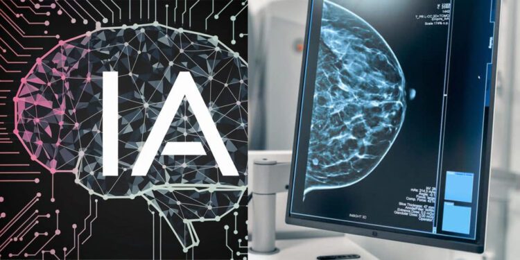 IA en el diagnóstico del cáncer de mama