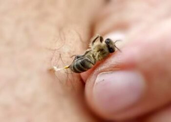 Foto: internet – ilustrativa // Las atenciones médicas por picadura de abeja muestran un aumento acelerado en lo que va del año.