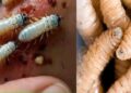 ¡AGUAS! Detectan primer caso de miasis humana por gusano barrenador