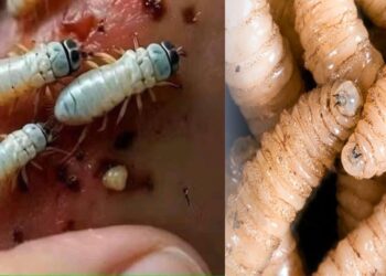 ¡AGUAS! Detectan primer caso de miasis humana por gusano barrenador