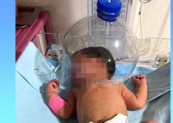 Usan botella de plástico para atender a bebé en hospital del IMSS-Bienestar en Tabasco