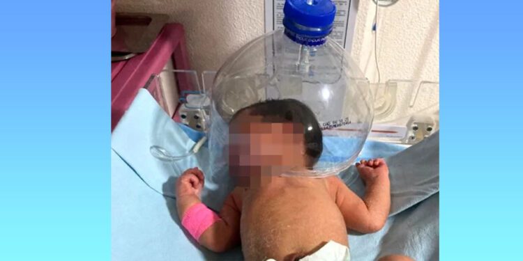 Usan botella de plástico para atender a bebé en hospital del IMSS-Bienestar en Tabasco
