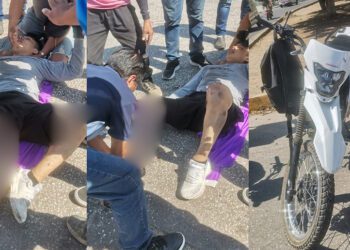 Motociclista sufre impactante accidente en Oaxaca: su pierna quedó completamente fracturada