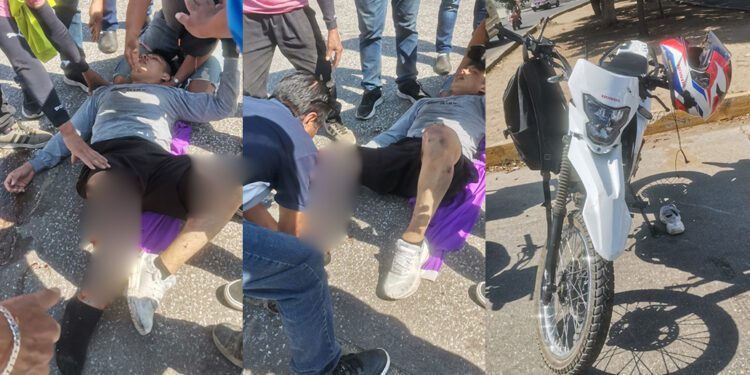 Motociclista sufre impactante accidente en Oaxaca: su pierna quedó completamente fracturada