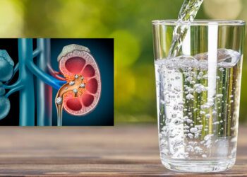 ¿Beber agua mineral puede causar cálculos renales? Esto dicen los expertos sobre sus riesgos y beneficios